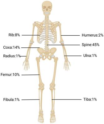 Progress of research on the diagnosis and treatment of bone cystic echinococcosis